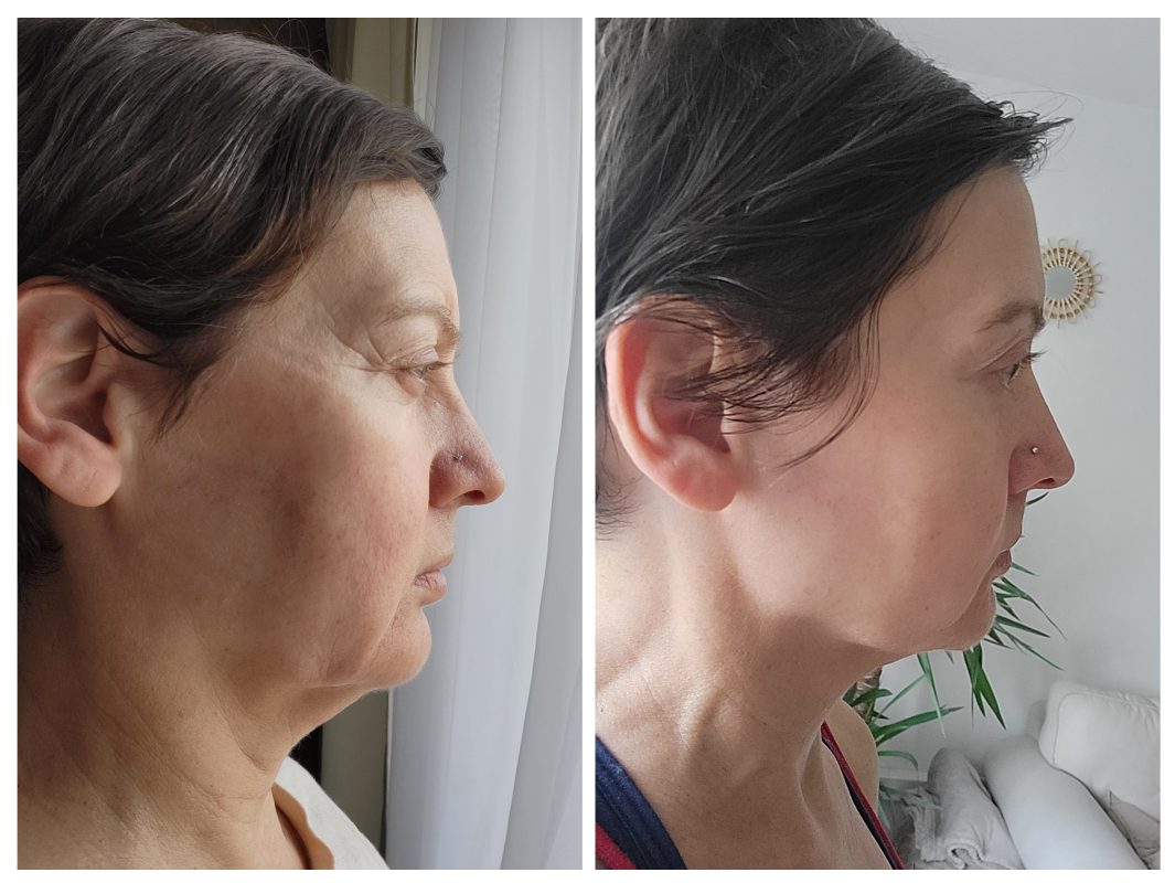 Obrazek #1 z Dorota Chmielewska