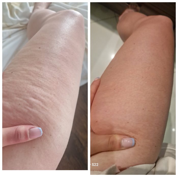 Obrazek #1 z Wow cellulit, naprawdę Wow!